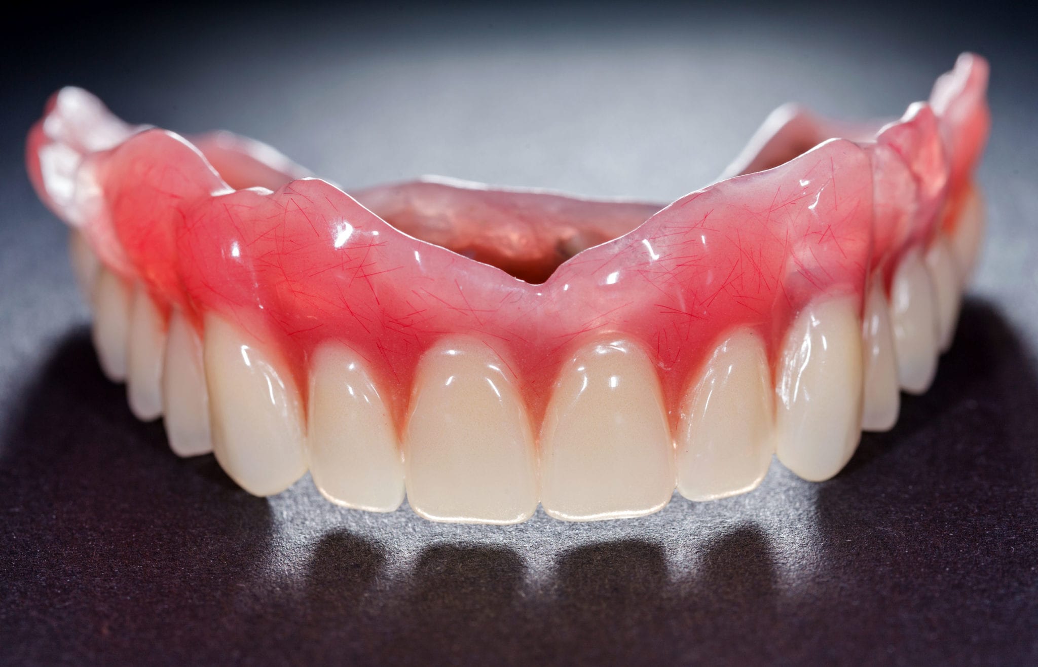 Implant-Supported Dentures